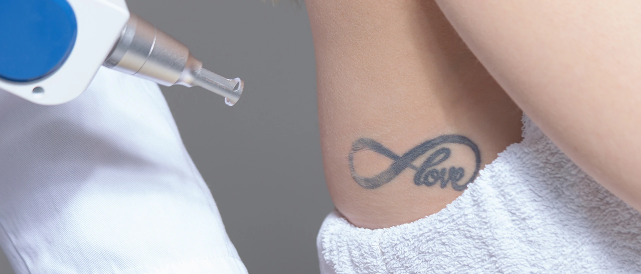 Détatouage femme